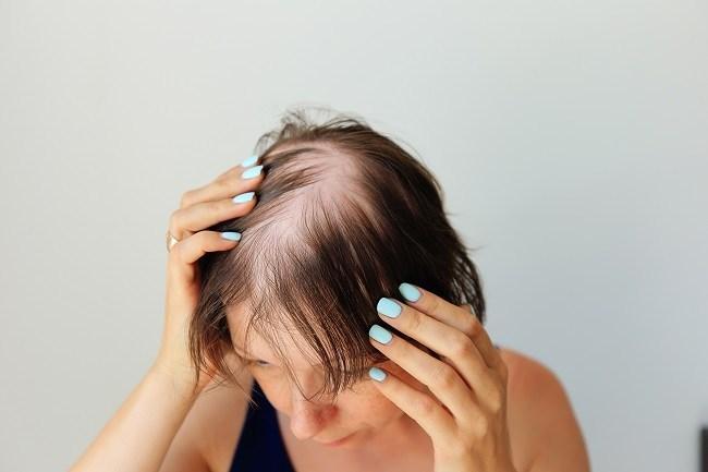 Agen Bonanza Anti Rontok – Solusi Ampuh untuk Rambut Sehat